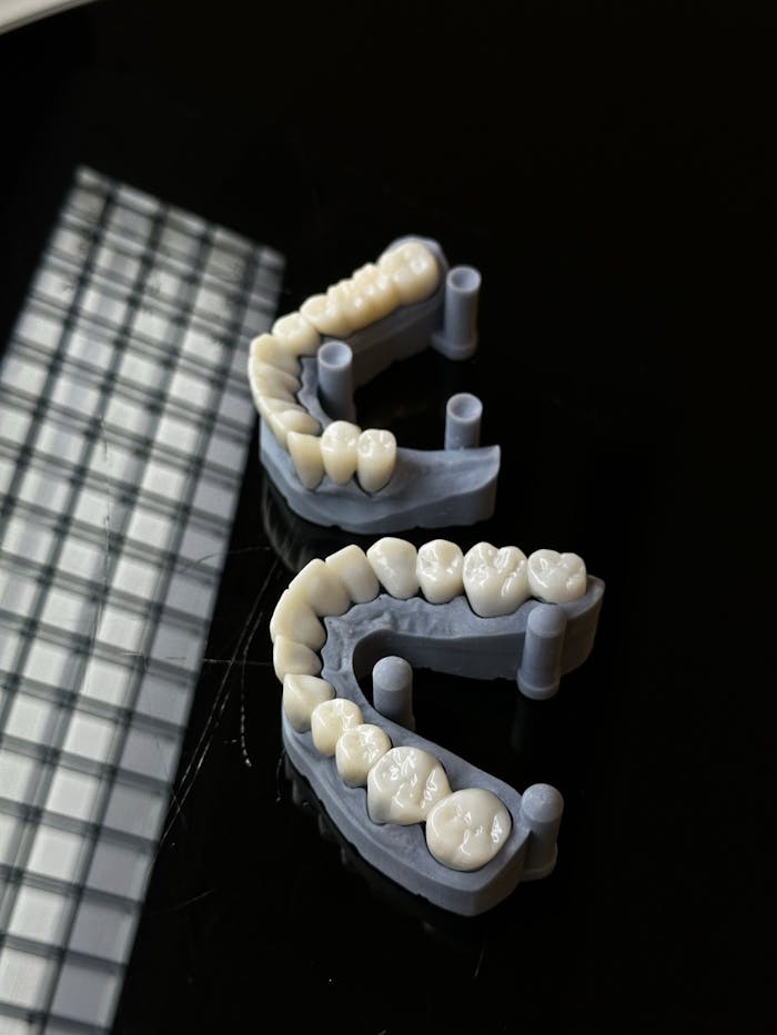 High-quality 3D printed dental molds displayed on a reflective dark background, showcasing dental technology.