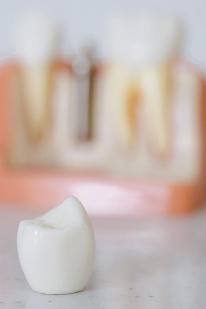 Detailed close-up of a dental prosthetic with a sterilized and blurred dental model background.