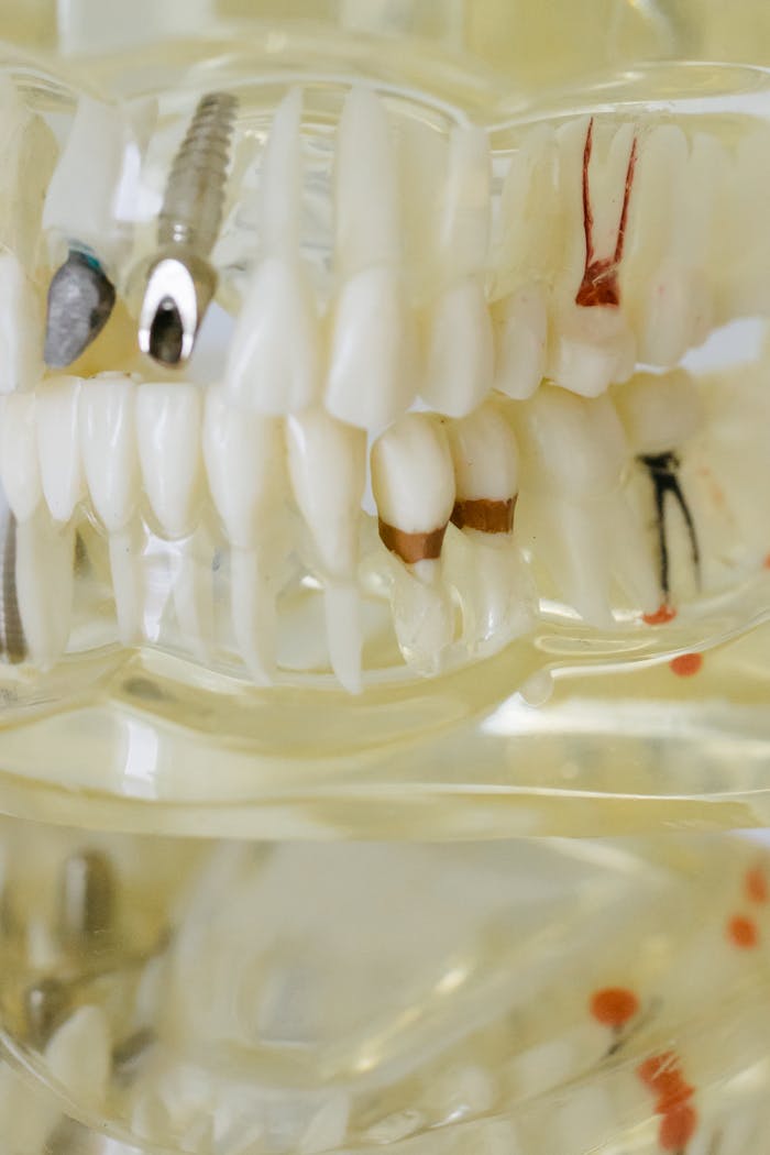Detailed close-up of a dental model showcasing implants, fillings, and orthodontic features.